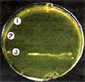 水虫菌の培養試験２